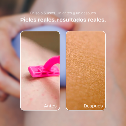 Depilador Black Friday 2x1