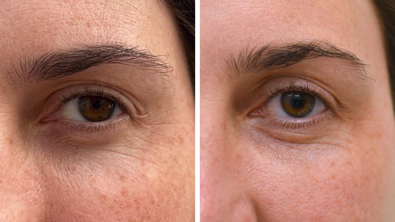 GUÍA DEFINITIVA para tu PIEL - Promo Navidad